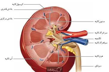 دستورالعملهای بالینی وزارت سال 1400-اصلاحیه استاندارد درمان جایگزینی مداوم کلیوی