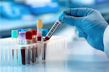 دستورالعملهای بالینی وزارت 1401- استانداردهای مربوط با آزمایش سل