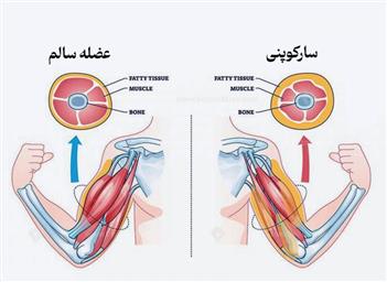 دستورالعملهای بالینی وزارت 1403- راهنمای بالینی مدیریت و درمان بیماری استئوپروز و سارکوپنی- مراکز