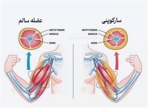 دستورالعملهای بالینی وزارت 1403- راهنمای بالینی مدیریت و درمان بیماری استئوپروز و سارکوپنی- مراکز