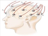 استاندارد خدمت EEG روتین در حالت خواب یا هوشیاری یا کما (کدملی 901220)