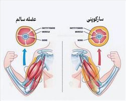 دستورالعملهای بالینی وزارت 1403- راهنمای بالینی مدیریت و درمان بیماری استئوپروز و سارکوپنی- مراکز