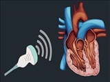 دستورالعملهای بالینی وزارت 1403- شناسنامه و استاندارد خدمت اکوکاردیوگرافی‌ داپلر بافتی (TDI) (کودکان)